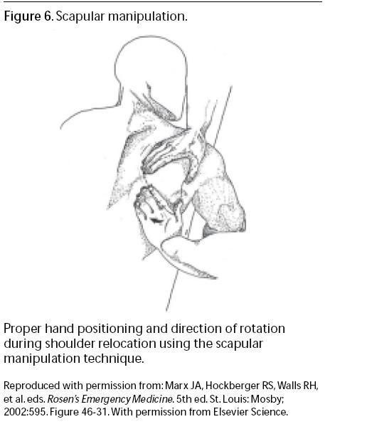 It is very important to reassess the shoulder examination following